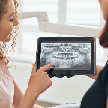 Zrozumienie roli tomografii stomatologicznej 3D w nowoczesnej diagnostyce